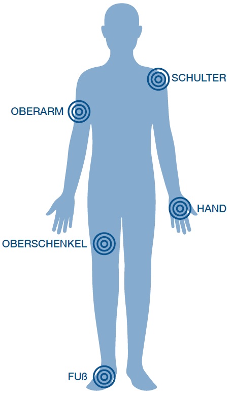 Wo sind Ihre Beschwerden?